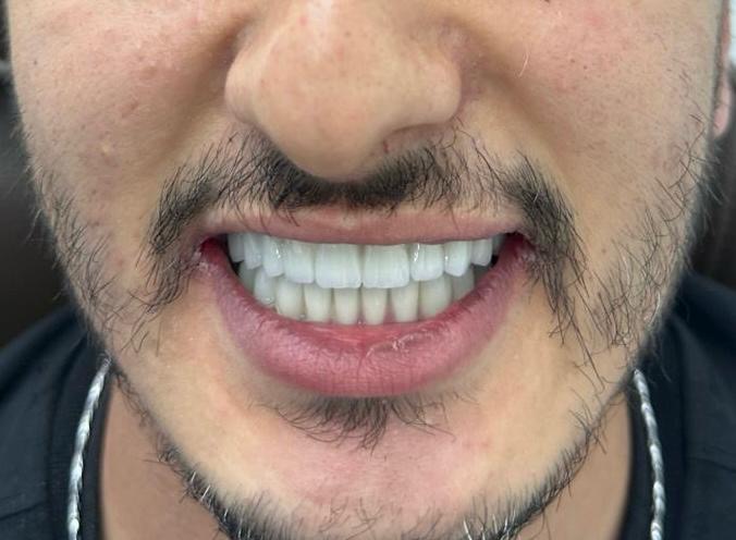 Sonrası